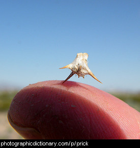 Photo of someone with a pricked finger