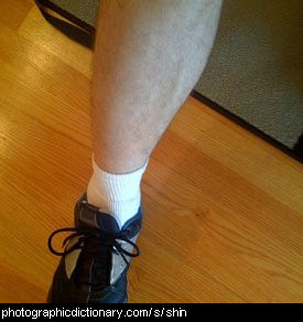 Photo of a man's shin